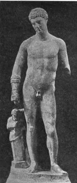 Statue of a Boxer by Koblanos of Aphrodisias